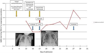 Case Report: A Severe Paediatric Presentation of COVID-19 in APDS2 Immunodeficiency